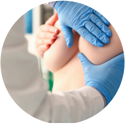 Результат пластики втянутых сосков