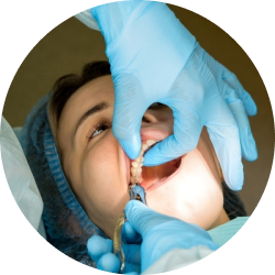 Простое удаление Простое удаление