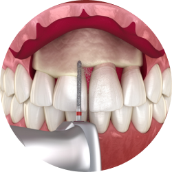 Радикальная