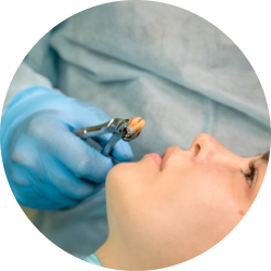 Простое удаление