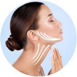 Результат SMAS-лифтинга