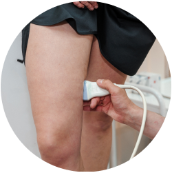 Реабилитация после пенной склеротерапии Восстановление после пенной склеротерапии