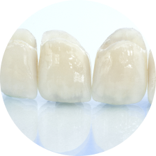 Зубные коронки на каркасе из диоксида циркония Зубные коронки на каркасе из диоксида циркония