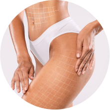 Восстановление после бодилифтинга