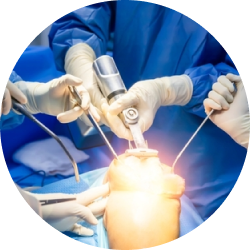 Результат эндопротезирования суставов Результат эндопротезирования суставов