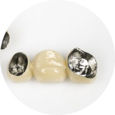 Комбинированные коронки (покрытые керамикой, двухслойные) Комбинированные коронки (покрытые керамикой, двухслойные)