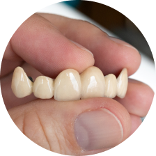 Керамические коронки E-max Керамические коронки E-max