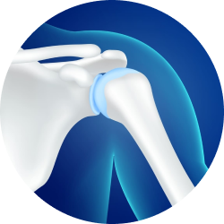 Реабилитация и восстановление после репозиции костей