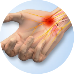 Восстановление и реабилитация после операции туннельного синдрома Восстановление и реабилитация после операции туннельного синдрома