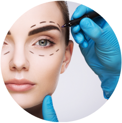 Результат бесшовной блефаропластики