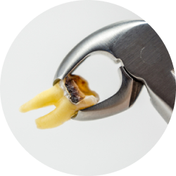 Сложное удаление Сложное удаление