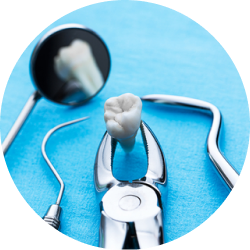 Экстракция щипцами