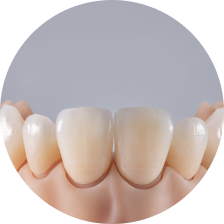 Керамические коронки Керамические коронки