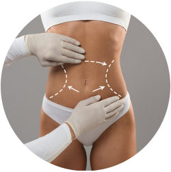 Результат пластики тела