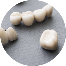 Цельнокерамические зубные коронки E-max Press Цельнокерамические зубные коронки E-max Press