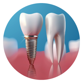 Импланты MIS Импланты MIS