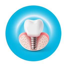 Импланты OSSTEM Импланты OSSTEM