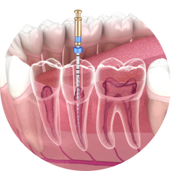 Терапевтический