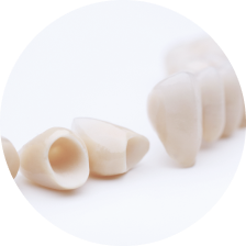 Циркониевые мосты