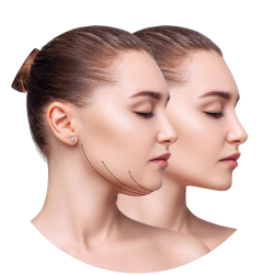 Восстановление после липосакции подбородка