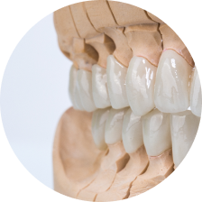 Коронки с плечевой массой Коронки с плечевой массой