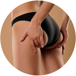 Восстановление после липофилинга ягодиц