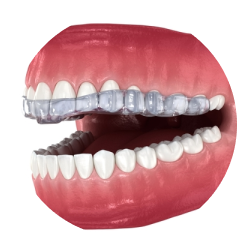 Шинирование зубов