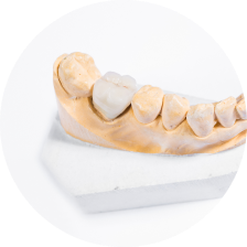 Микропротезы из диоксида циркония