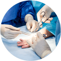 Результат операции пластики сухожилий Результат операции пластики сухожилий