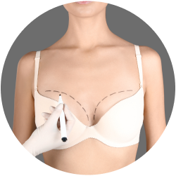 Восстановление после маммопластики груди