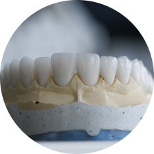 Зубные коронки из керамики Empress Зубные коронки из керамики Empress