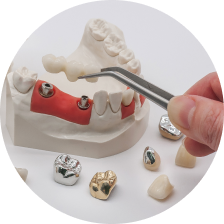 Коронки с каркасом из драгоценных металлов Коронки с каркасом из драгоценных металлов