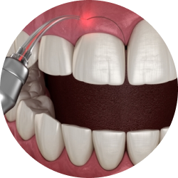 Простая (классическая)