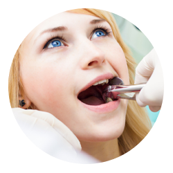 Удаление корня зуба