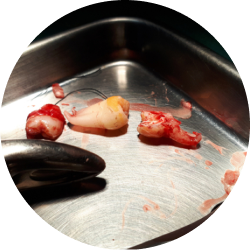 Сложное удаление