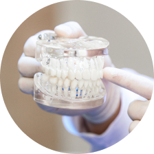 Изделия из керамики E-max Изделия из керамики E-max